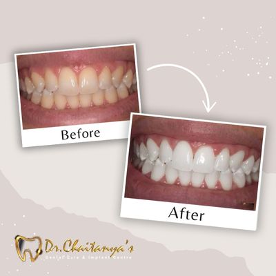 Dentist in Jeevan Bima Nagar