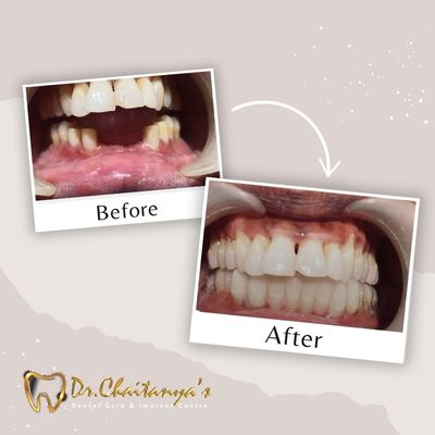 Dentist in Jeevan Bima Nagar