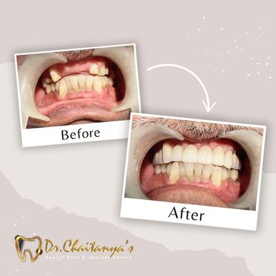 Dental Clinic in Jeevan Bima Nagar