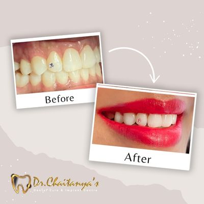 Dental Clinic in Jeevan Bima Nagar