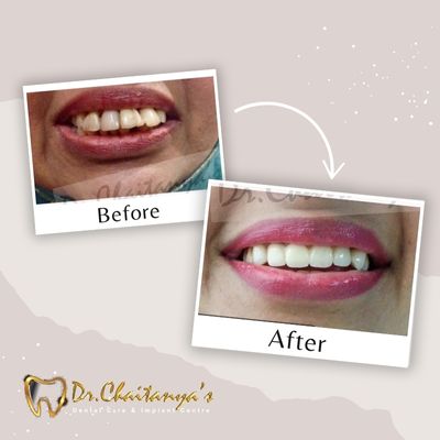 Dentist in Jeevan Bima Nagar